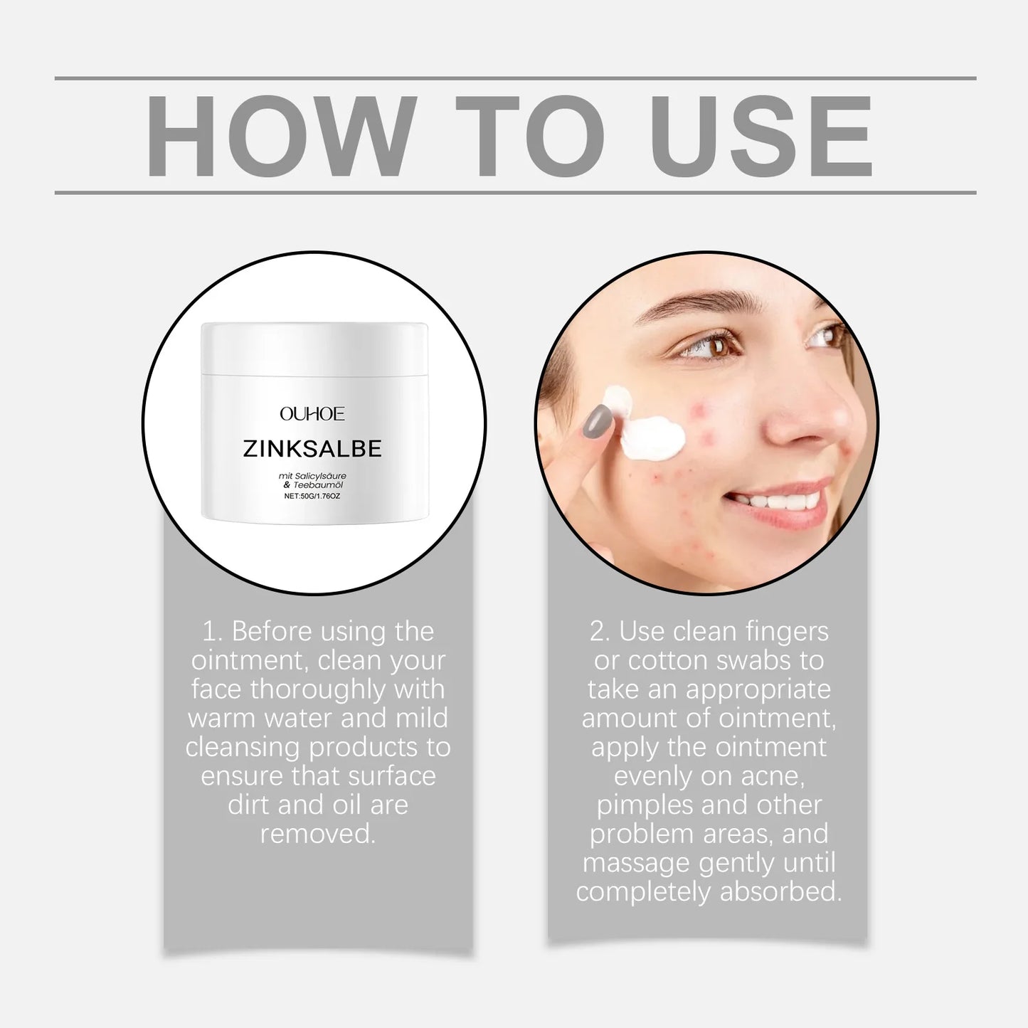 Acne Removal Cream Against Pimples Marks Lighten Shrink Pores Oil Control Whitening Smoothing Nourishing Repairing Zinc Ointment