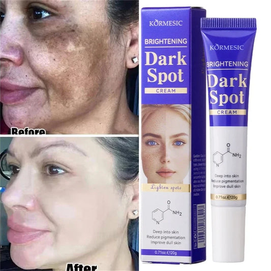 Dark Spots Removal Cream Facial Whitening Freckle Acne Mark Pigmentation Removal Melanin Skin Correction Brighten Care Products