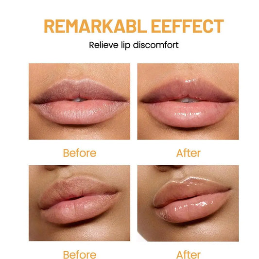 6/24pcs Assorted Fruit Flavor Lip Balm Set - Hydrating, Nourishing & Prevents Chapped Lips - Care for Dry Lips & Fine Lines