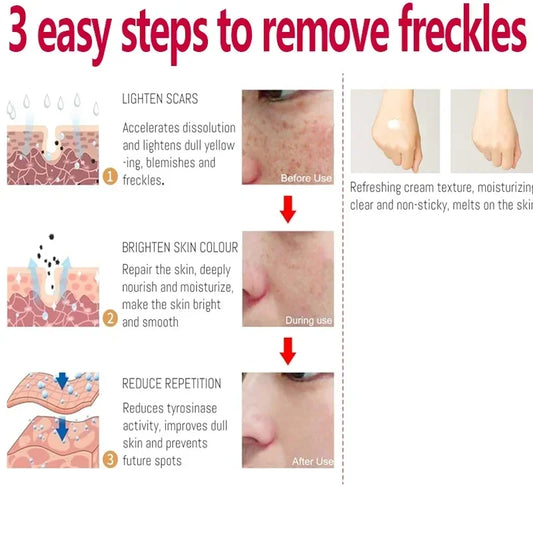 Whitening Freckle Cream Effectively reduces dark spots Brightens and revitalizes dull skin Hydrates and nourishes the skin