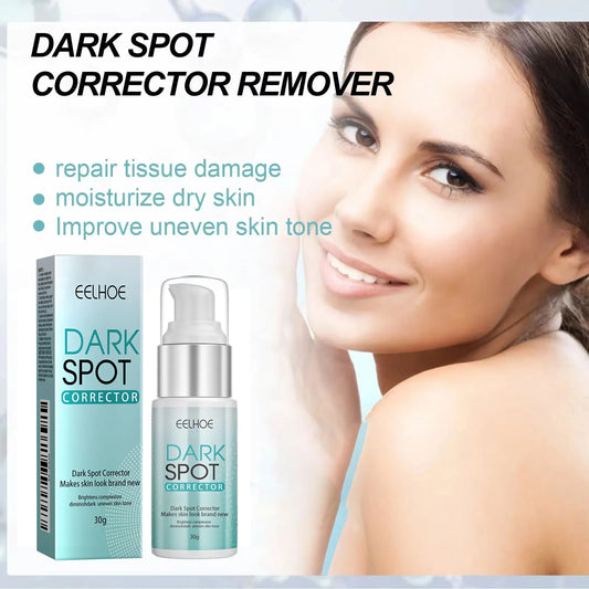 Freckle Whitening Cream Fade Dark Spot Blemish Acne Mark Remove Melanin Shrink Pores Lightening Pigmentation Correction Cream