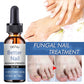 TRSTAY 50ml Nail Cuticle Nutrient Oil Nourishes and Repairs Damaged Nails Moisturizing Strengthens and Brightens Nail Care