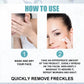 Freckle Whitening Cream Fade Dark Spot Blemish Acne Mark Remove Melanin Shrink Pores Lightening Pigmentation Correction Cream