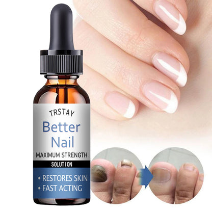 TRSTAY 50ml Nail Cuticle Nutrient Oil Nourishes and Repairs Damaged Nails Moisturizing Strengthens and Brightens Nail Care