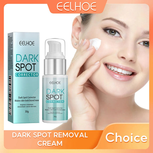 Freckle Whitening Cream Fade Dark Spot Blemish Acne Mark Remove Melanin Shrink Pores Lightening Pigmentation Correction Cream