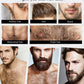 The most effective beard growth essence in 2025, grow a thick beard in 7 days. Chest hair, leg hair, beard and hair growth
