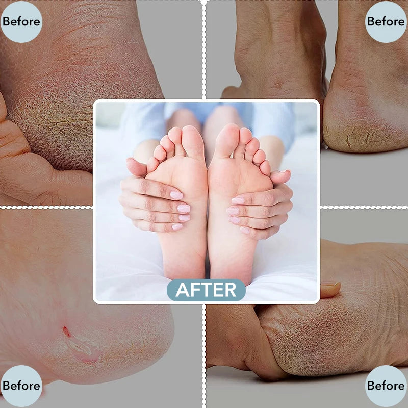 Stainless Steel Foot Scraper Metal Foot File Double SidedCallus Remover Professional for Wet or Dry SkinPedicure Tool Heel