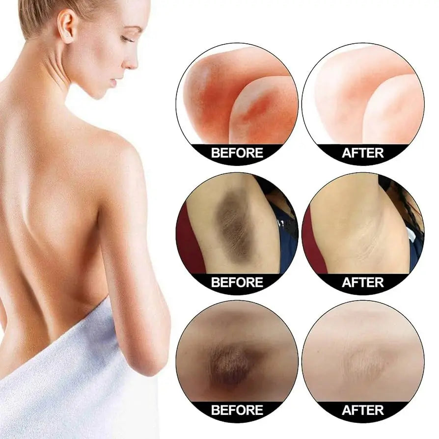 Body Whitening Cream Private Parts Underarm Dark Skin Bleaching Serum Niacinamide Whitening Lighten Dark Spots Snow Bleach Cream