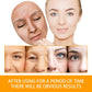 Anti Acne Turmeric Cream, Fades Scars & Dark Spots, for Oily and Dull Skin, Brightening Turmeric Face Care Treatment, 50ml