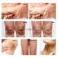 Body Whitening Lotion Dark Spot Remover For Underarms Knees Elbows Melanin Bleaching Lightening Skin Moisturizing Cream