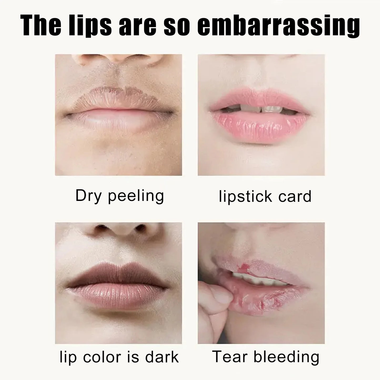 EELHOE Collagen Cherry Lip Mask Nourishing Repair Lips Plumper Lighten Lines Firming Moisturizing Anti-dryness Labial Gel Patch