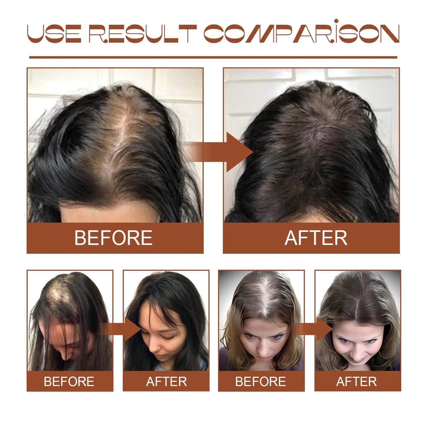 100% Pure Organic Hair Mask Batana Oil Hair Growth Oil Natural Treatment Nourish Reduce Hair Loss Anti-Breakage Hair Products