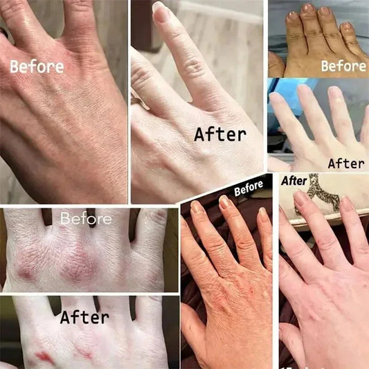 Wrinkle Removal Soften Nourish Anti-drying Whitening Moisturizing Hand Care  Anti-Crack Hand Cream Skin Cracked Repair Products