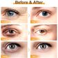 Instant Eye Bag Removal Rolling Beads Massage Serum Retinol Anti-Wrinkle Firm Skin Anti Dark Circle Puffiness Brighten Eye Care