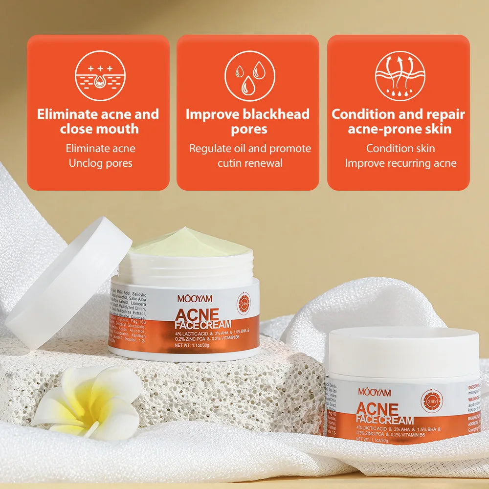 Herbal Acne Removal Face Cream Anti-Acne Gel Treatment Acne Scar Pore Shrinking Eliminate Large Pores Pimples Whitening Face Car