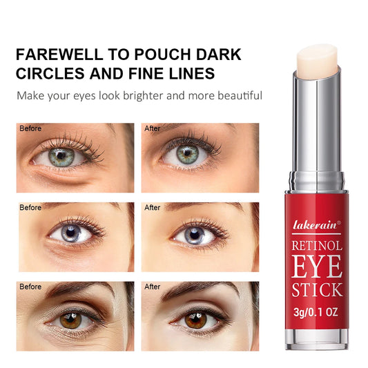 Retinol Eye Cream Lightening Dark Circles Firming Skin Instant Eye Repair Serum Stick for women Women Eyes Care