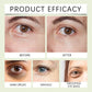 HOYGI Collagen Eye Serum Anti Puffiness Eye Bags Anti Dark Circles Moisturizing Tightening Reduce Fine Lines Skin Care Roller