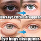 Instant Eye Bag Removal Rolling Beads Massage Serum Retinol Anti-Wrinkle Firm Skin Anti Dark Circle Puffiness Brighten Eye Care