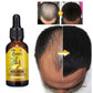 Ginger Hair Care Oil Hair Roots Scalp Treatment Improve Androgenetic Alopecia Scalp Treatment Serum Strengthen Hair Roots