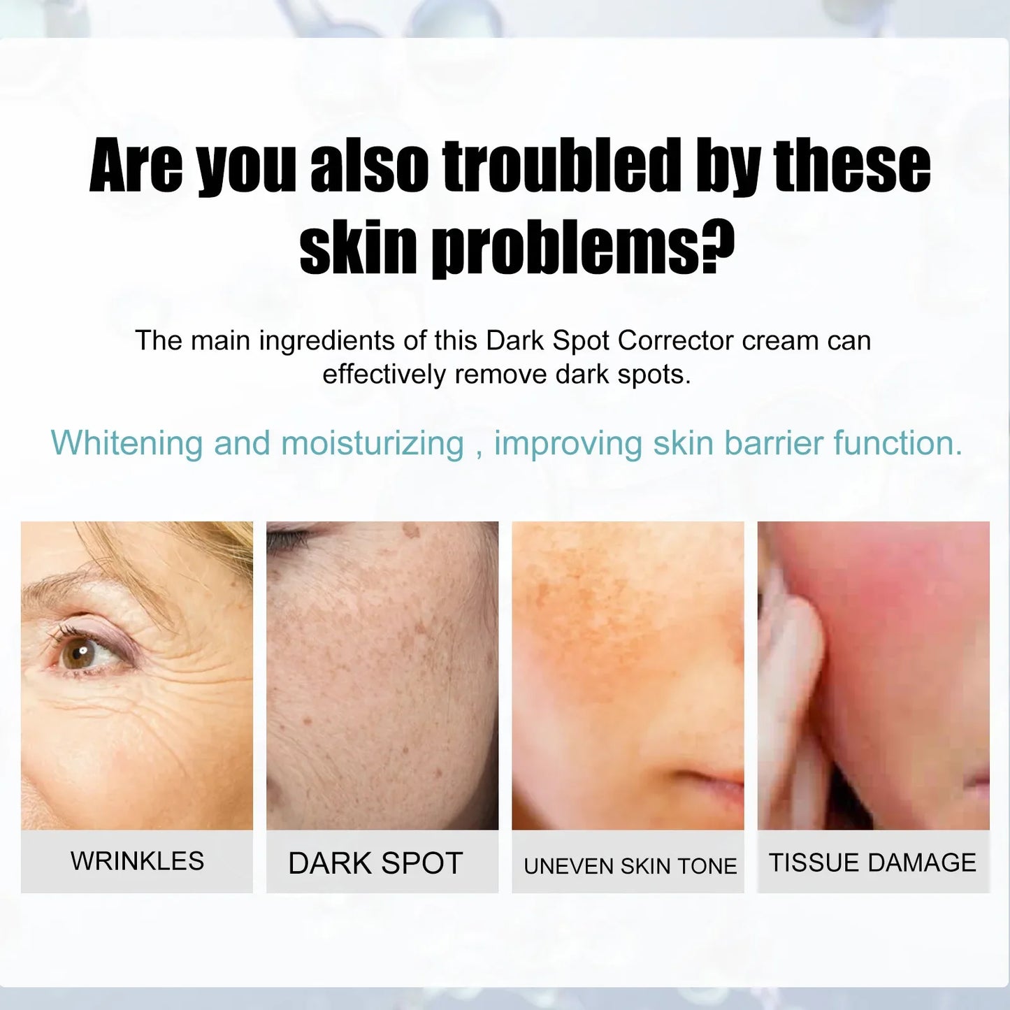 Freckle Whitening Cream Fade Dark Spot Blemish Acne Mark Remove Melanin Shrink Pores Lightening Pigmentation Correction Cream