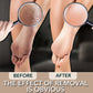1pcs Nano Glass Double-sided Foot Rasp Heel File Hard Dead Skin Callus Remover Exfoliating Pedicure Care Foot File Tool