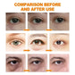 Anti Dark Circle Eye Serum Oil Retinol Anti Wrinkle Firming Skin Remove Eye Bag Fade Fine Line Whitening Brighten Eye Care Korea
