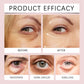 OUHOE Eye Cream Stick, Hyaluronic Acid, Tocopherol, Glycerin, Eye Area, Tightening and Moisturizing, 3.00g