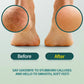NAILPOP Extra Strength Callus Remover for Feet and Foot File Kit Remove Hard Skins Heels and Tough Callouses from feet Quickly