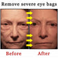 selling wrinkle removing eye cream, eye bags, dark circles, anti swelling, firming, brightening, fine lines, moisturizing tool