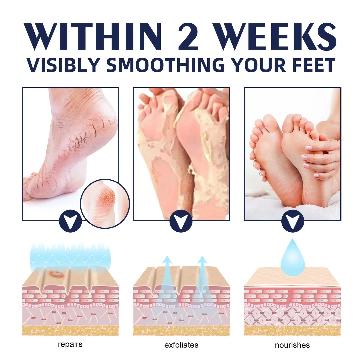 Anti-Drying Crack Hand Foot Care Cream Heel Cracked Repair Products  Removal Dead Skin Moisturizing Whitening Nourish Skin Care