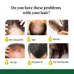 Ginger Care Hair Spray Hair Growth Essence Nourish Hair Roots Massag Scalp Repair Hair Quality Control Oil Hair Care Solution