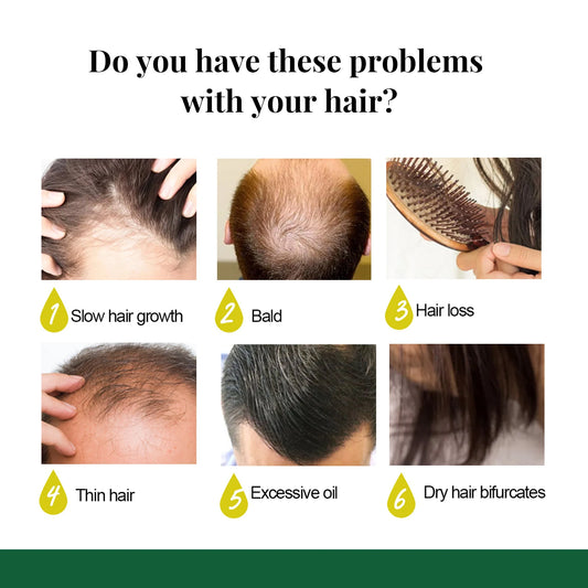 Ginger Care Hair Spray Hair Growth Essence Nourish Hair Roots Massag Scalp Repair Hair Quality Control Oil Hair Care Solution