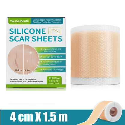 1 Roll Silicone Scar Sheets , 4cmX150cm Self-Adhesive Scar Cover Tape Reusable and Effective Skin Care Strips