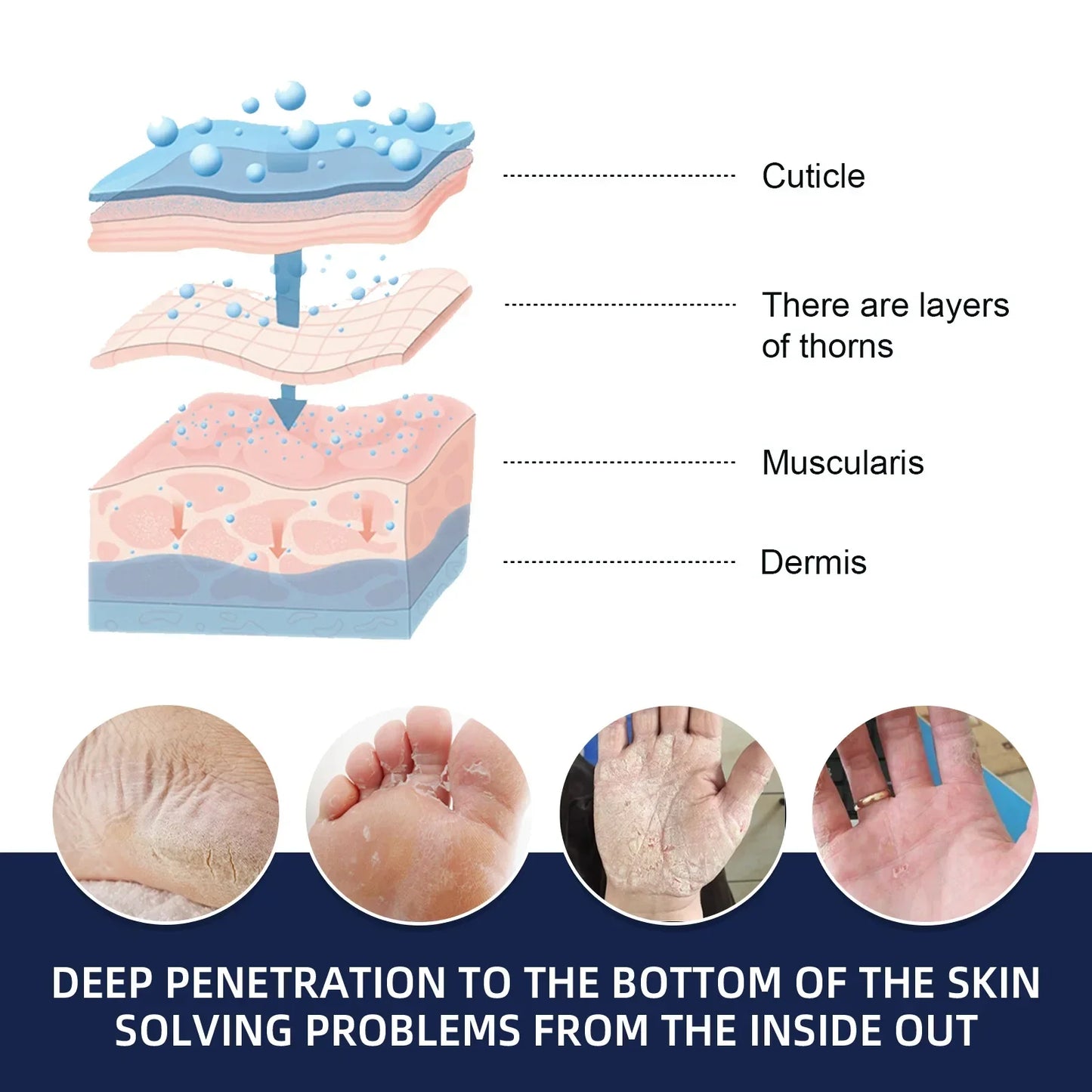 Anti-Drying Crack Hand Foot Care Cream Heel Cracked Repair Products  Removal Dead Skin Moisturizing Whitening Nourish Skin Care