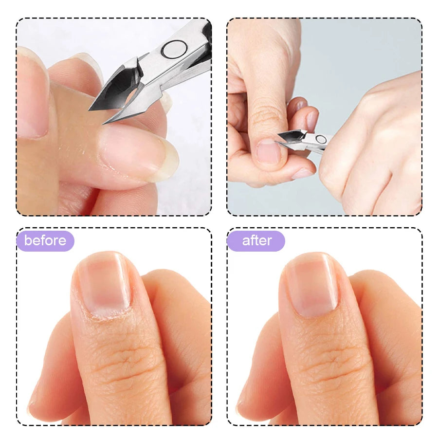 QAZIXU 10ml Nail Care Cuticle Remover Nail Polish for Dead Skin Gel Manicure Treatment Tool For Nail Art DIY Salon Home