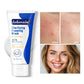 Acne Foaming Wash Deep Cleaning Unclogs Pores Prevents Breakouts for Face & Body Moisturizers Reduces Redness Skin Care