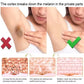 Body Whitening Cream Dark Skin Armpit Lightening Intimate Areas Underarm Bleaching Private Parts Whiten Cream Body Lotion Beauty