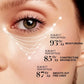Bee Venom & Caffeine Firming Eye Cream - Collagen & Hyaluronic Acid Formula to Reduce Dark Circles, Wrinkles & Revitalize Skin.
