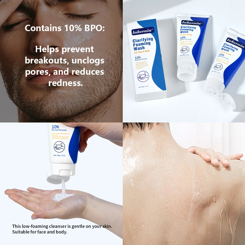Acne Foaming Wash Deep Cleaning Unclogs Pores Prevents Breakouts for Face & Body Moisturizers Reduces Redness Skin Care