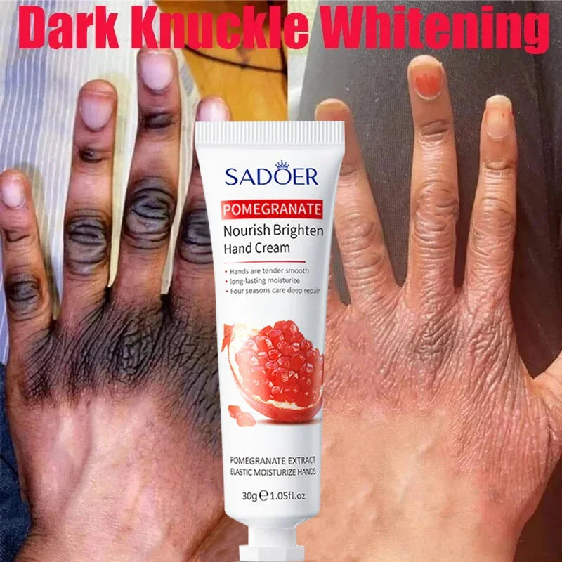 Wrinkle Removal Soften Nourish Anti-drying Whitening Moisturizing Hand Care  Anti-Crack Hand Cream Skin Cracked Repair Products