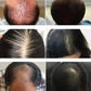 Rosemary Hair Growth Oil Anti Hairs Loss Treatment Mint Hair Strengthening Oil Nourishing Roots Regrowth Hair For Men Women 50ml