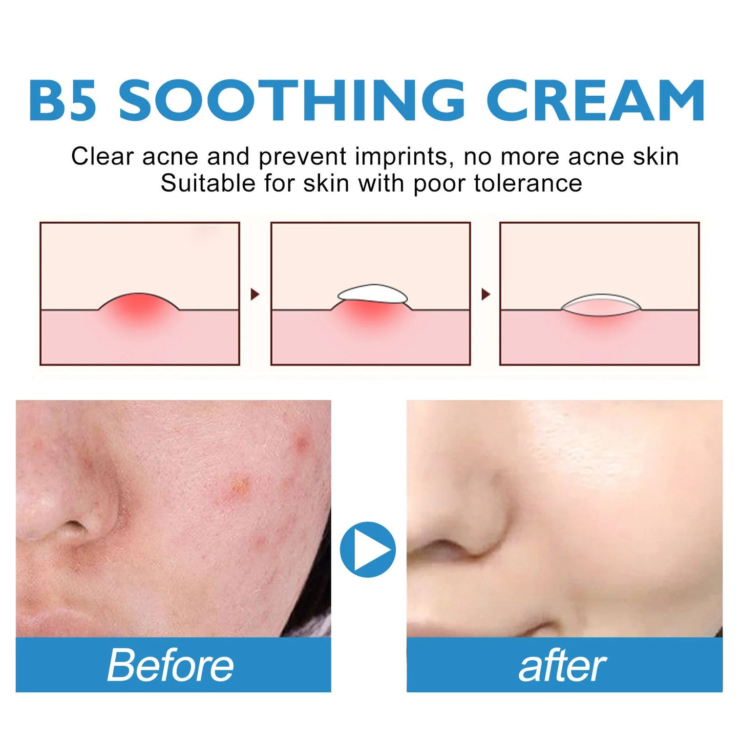 1/3/5PCS B5 Repair Cream Moisturizing Hydrating Solves Dry Chapped Red Skin Nourishes Improve Repair Sunscreen Beauty Face Cream