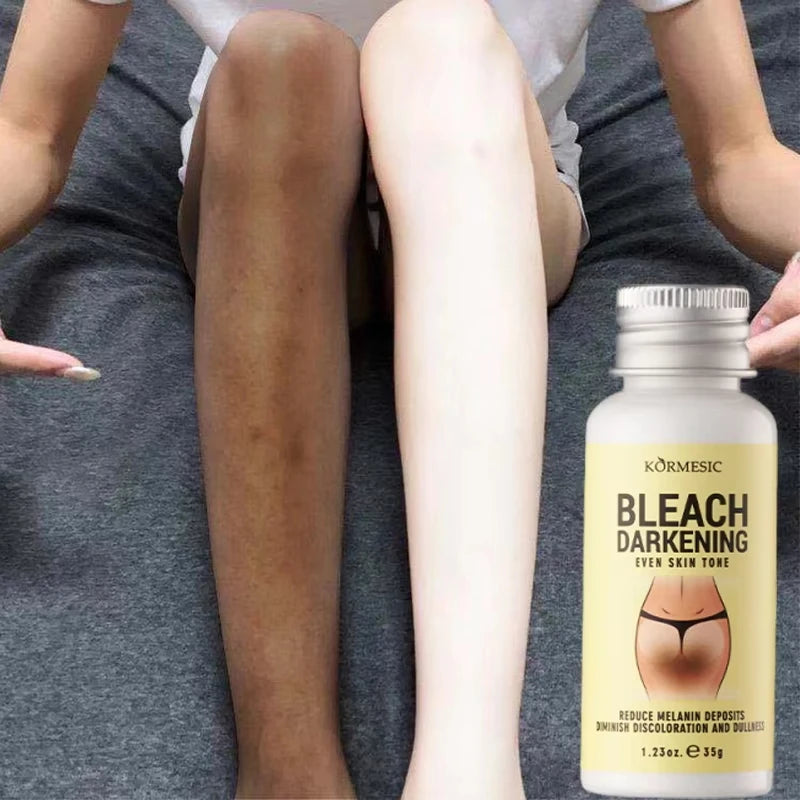 Whitening Body Cream Private Parts Underarm Bleaching Serum Whiten Butt Knee Brighten Inner Thigh Intimate Dark Remove Melanin