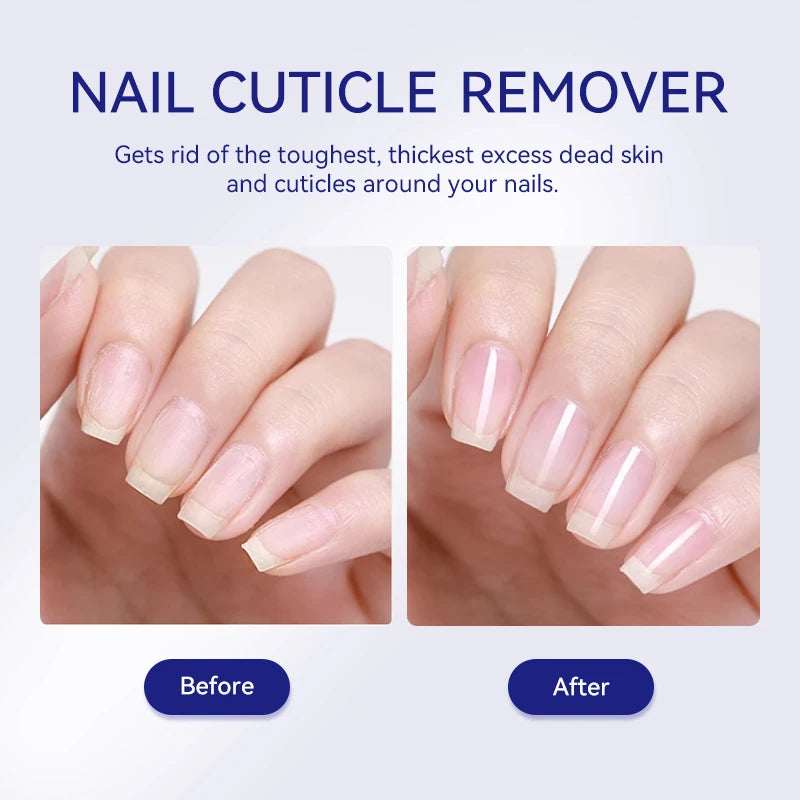 LILYCUTE 30ml Nail Cuticle Remover Quick Softening Gel For Nail Dead Skin Gentle Remover Manicure Care Easy Cuticle Cleaner Tool