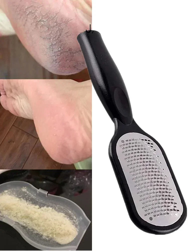 RHBJ 1Pcs Professional Stainless Steel Callus Remover Hand Foot File Scraper Pedicure Tools Dead Skin Remove for Heels Feet Care