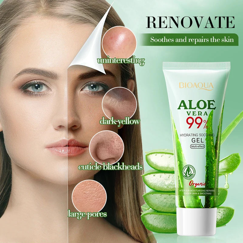 Aloe Vera Gel 100% Natural For Face And Body, Hydrating Moisturizing  Soothing Skin For Sunburn Relief, Acne, After Sun Care 50g