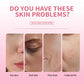 Lakerain Bio-Collagen Sleeping Mask Facial Skin Care Hydrating Moisturizing Patch Mask Moisturizing Peel-Off Mask Single Sheet