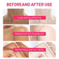 Body Whitening Bleach Cream Brighten Underarm Elbow Knees Joint Removal Intimate Parts Dark Spots Melanin Snow Bleach Cream