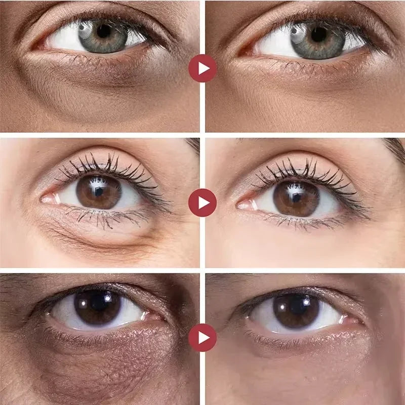 Anti Dark Circle Eye Serum Oil Retinol Anti Wrinkle Firming Skin Remove Eye Bag Fade Fine Line Whitening Brighten Eye Care Korea