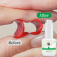 AWStorG 15ml 8 In 1 Reinforcement Gel Nail Gel Multifunctional Clear Gel Nail Polish Nail Strengthener Gel Nail Extension Hard